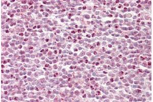 Anti-HCFC1 / HCF-1 antibody IHC staining of human tonsil. (HCFC1 anticorps  (AA 131-180))