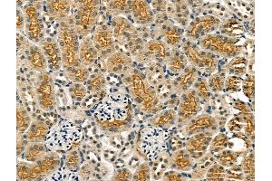 ABIN7094436 and ABIN7098484 at 1/100 staining Mouse kidney tissue by IHC-P.