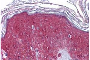 Human Skin: Formalin-Fixed, Paraffin-Embedded (FFPE)