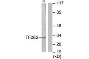 Western Blotting (WB) image for anti-General Transcription Factor IIE, Polypeptide 2 (GTF2E2) (AA 151-200) antibody (ABIN2889444) (GTF2E2 anticorps  (AA 151-200))