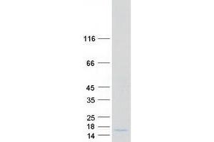 Validation with Western Blot