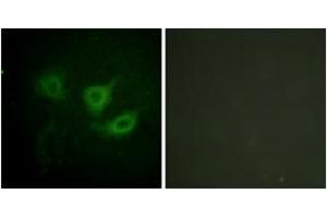 Immunofluorescence analysis of HuvEc cells, using p70 S6 Kinase (Phospho-Thr389) Antibody. (RPS6KB1 anticorps  (pThr412))