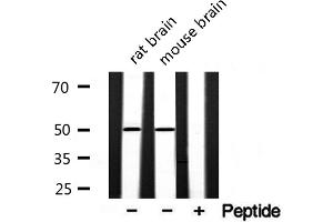 Western blot analysis of extracts of various samples,using akt1/3 Antibody. (AKT1/3 anticorps)