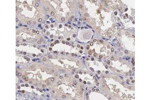 ABIN6267405 at 1/200 staining human kidney tissue sections by IHC-P. (Stathmin 1 anticorps  (pSer25))