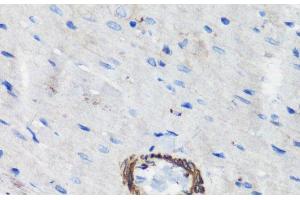 Immunohistochemistry of paraffin-embedded Rat heart using FLNA Polyclonal Antibody at dilution of 1:100 (40x lens). (Filamin A anticorps)