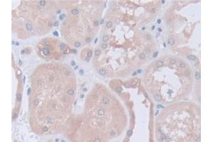Detection of CAPNS1 in Human Kidney Tissue using Polyclonal Antibody to Calpain, Small Subunit 1 (CAPNS1)