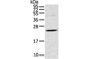 Western blot analysis of Human fetal brain tissue, using TSPAN13 Polyclonal Antibody at dilution of 1:550