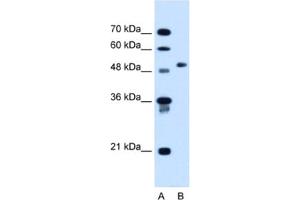 Western Blotting (WB) image for anti-Collagen, Type VI, alpha 2 (COL6A2) antibody (ABIN2462902) (COL6A2 anticorps)