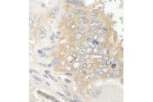 anti-Ankyrin Repeat and Sterile alpha Motif Domain Containing 1B (ANKS1B) (AA 245-268) antibody