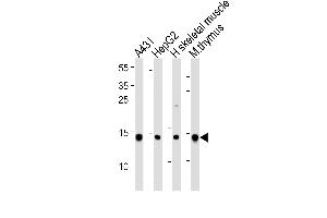 Western blot analysis of lysates from A431, HepG2 cell line, human skeletal muscle and mouse thymus tissue lysate(from left to right), using hUBE2D1- B. (UBE2D1 anticorps  (C-Term))