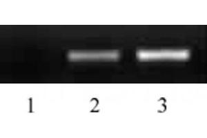 Histone H2B acetyl Lys16 pAb tested by ChIP analysis. (Histone H2B anticorps  (acLys16))