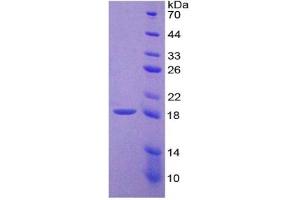 SDS-PAGE (SDS) image for Tumor Necrosis Factor (Ligand) Superfamily, Member 11 (TNFSF11) ELISA Kit (ABIN6574228)