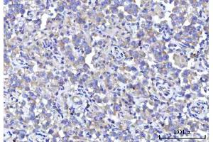 IHC analysis of RPS5 using anti-RPS5 antibody (ABIN7599076). (RPS5 anticorps  (AA 1-204))