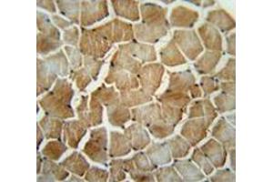 Immunohistochemistry analysis human skeletal muscle (Formalin-fixed, Paraffin-embedded) using MRM1 Antibody (N-term), followed by peroxidase conjugated secondary antibody and DAB staining.