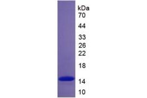 SDS-PAGE of Protein Standard from the Kit  (Highly purified E. (Complement Factor B Kit ELISA)