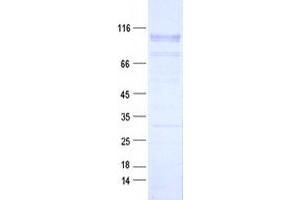 Validation with Western Blot