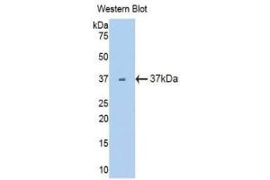 Western Blotting (WB) image for anti-Fms-Related tyrosine Kinase 1 (VEGFR1) (FLT1) (AA 27-329) antibody (ABIN3206010) (FLT1 anticorps  (AA 27-329))
