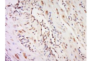 Paraformaldehyde-fixed, paraffin embedded mouse placenta, Antigen retrieval by boiling in sodium citrate buffer (pH6) for 15min, Block endogenous peroxidase by 3% hydrogen peroxide for 30 minutes, Blocking buffer (normal goat serum) at 37°C for 20min, Antibody incubation with 	NOR1 Polyclonal Antibody, Unconjugated  at 1:500 overnight at 4°C, followed by a conjugated secondary and DAB staining.