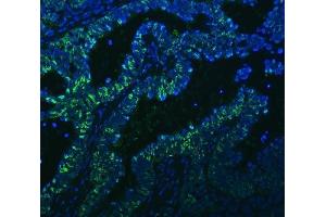 anti-Activated RNA Polymerase II Transcriptional Coactivator p15 (SUB1) (AA 96-127), (C-Term) antibody