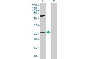 Western Blot analysis of LIN7A expression in transfected 293T cell line by LIN7A MaxPab polyclonal antibody. (LIN7A anticorps  (AA 1-233))