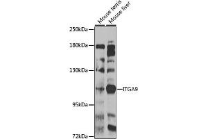 Western blot analysis of extracts of various cell lines, using ITG antibody (ABIN6133048, ABIN6142571, ABIN6142573 and ABIN6223622) at 1:1000 dilution. (ITGA9 anticorps  (AA 30-250))