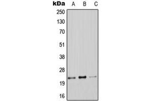 Western blot analysis of Claudin 9 expression in A549 (A), Raw264. (Claudin 9 anticorps  (C-Term))