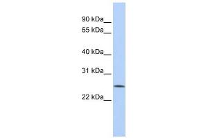 FBXO22 antibody used at 1 ug/ml to detect target protein.