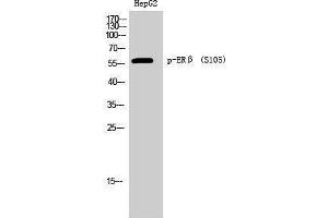 Western Blotting (WB) image for anti-Estrogen Receptor 2 (ESR2) (pSer105) antibody (ABIN3173178) (ESR2 anticorps  (pSer105))