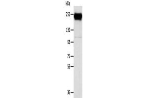 Gel: 6 % SDS-PAGE, Lysate: 40 μg, Lane: K562 cells, Primary antibody: ABIN7130945(RRBP1 Antibody) at dilution 1/400, Secondary antibody: Goat anti rabbit IgG at 1/8000 dilution, Exposure time: 10 seconds (RRBP1 anticorps)