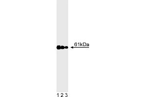 Western Blotting (WB) image for anti-Calcineurin (CAN) (AA 349-505) antibody (ABIN967510) (CAN anticorps  (AA 349-505))