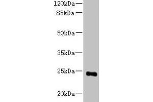Western blot All lanes: MED18 antibody at 0. (MED18 anticorps  (AA 35-208))