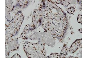 Image no. 3 for anti-AT Rich Interactive Domain 1B (SWI1-Like) (ARID1B) (AA 1364-1461) antibody (ABIN599288) (ARID1B anticorps  (AA 1364-1461))