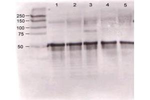 Rabbit anti-Ang-1 was used at a 1:500 dilution to detect mouse Ang-1 by western blot against supernatants of mouse angiopoietin-expressing endothelial cells. (Angiopoietin 1 anticorps  (N-Term))