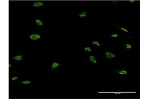 Immunofluorescence of monoclonal antibody to LHX4 on HeLa cell. (LHX4 anticorps  (AA 291-390))