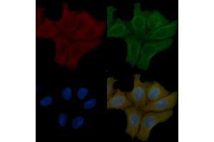 SOD1 Mouse Monoclonal Antibody staining Hela cells by IF/ICC.