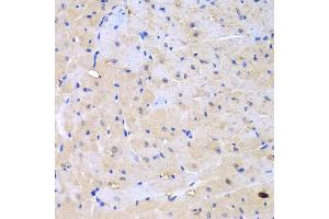 Immunohistochemistry of paraffin-embedded mouse heart using ARHGEF9 antibody at dilution of 1:100 (40x lens). (Arhgef9 anticorps)