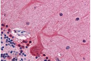 Human Brain, Cerebellum: Formalin-Fixed, Paraffin-Embedded (FFPE)