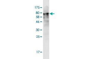 Western Blot detection against Immunogen (73. (LACC1 anticorps  (AA 1-430))