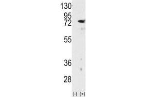 Western blot analysis of PKC delta antibody and 293 cell lysate either nontransfected (Lane 1) or transiently transfected with the PRKCD gene (2).