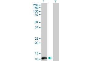 Western Blotting (WB) image for anti-Cleavage Stimulation Factor, 3' Pre-RNA, Subunit 3, 77kDa (CSTF3) (AA 1-104) antibody (ABIN598634) (CSTF3 anticorps  (AA 1-104))