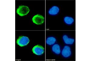 Immunofluorescence staining of fixed Jurkat cells with anti-CD154 antibody IDEC-131 (Toralizumab). (Recombinant sCD40L (Toralizumab Biosimilar) anticorps)
