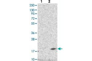 DPM3 anticorps