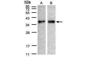 WB Image Sample(30 μg of whole cell lysate) A:A431, B:HeLa S3, 12% SDS PAGE antibody diluted at 1:500 (ZPBP anticorps)