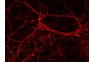 Indirect immunostaining of PFA fixed rat hippocampus neurons (dilution 1 : 500).