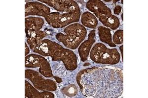 Immunohistochemical staining of human kidney with CRYL1 polyclonal antibody  shows strong cytoplasmic positivity in cells in tubules along with distinct extracellular material. (CRYL1 anticorps)