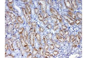 IHC testing of FFPE mouse kidney tissue with Galectin 1 antibody at 1ug/ml.