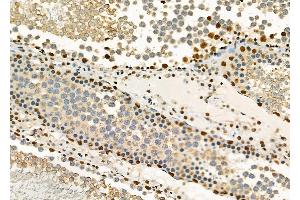 ABIN6261827 and ABIN6278382 at 1/100 staining Rat testis tissue by IHC-P. (FTO anticorps  (C-Term))