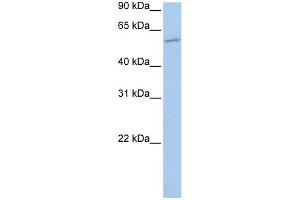 WB Suggested Anti-MBOAT1 Antibody Titration:  0. (MBOAT1 anticorps  (N-Term))