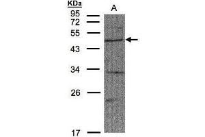 WB Image Sample(30 μg of whole cell lysate) A:A431, 10% SDS PAGE antibody diluted at 1:1500 (FBXW2 anticorps  (C-Term))