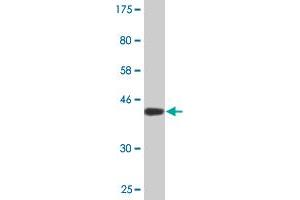 Western Blot detection against Immunogen (40. (BRD3 anticorps  (AA 418-556))